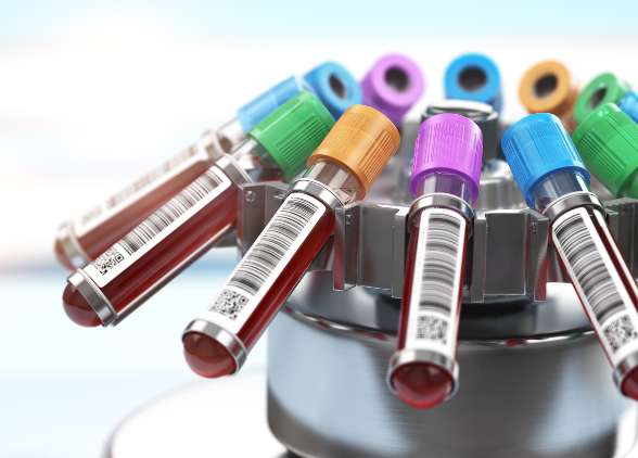 Como detectar drogas no sangue - exame toxicológico