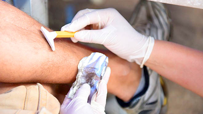 Resultado de imagem para exame toxicologico