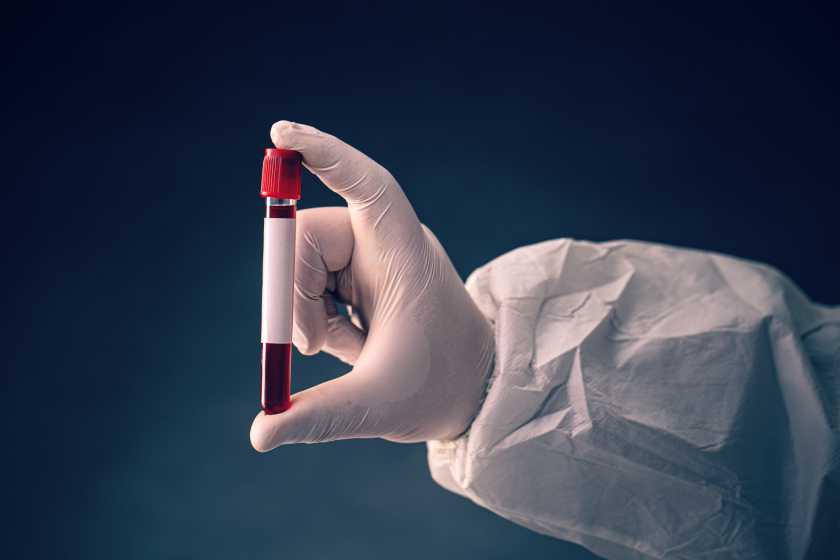 como detectar drogas no sangue